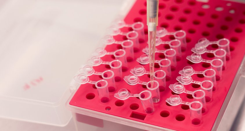Per a què serveix una biòpsia d'endometri?