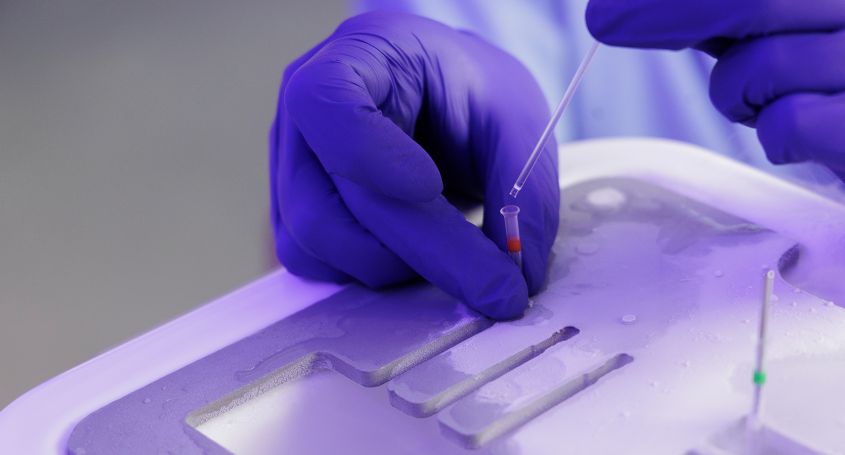 Preservar la fertilitat amb la vitrificació d'òvuls