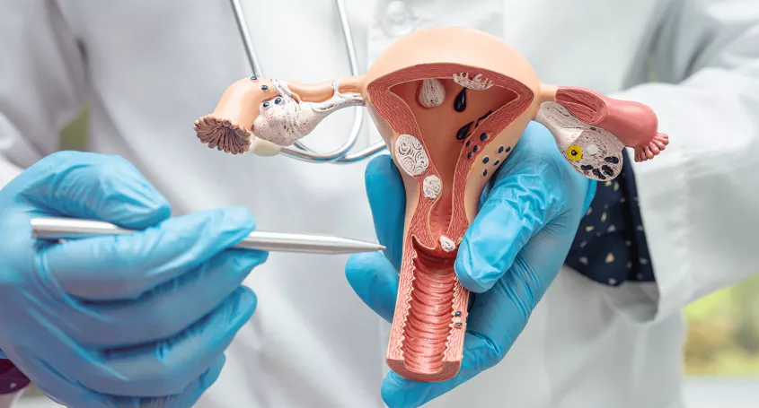 Ektope Schwangerschaft: Besteht ein Risiko nach der IVF?