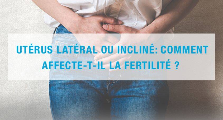 Utérus inversé:comment affecte-t-il la fertilité? | Barcelona IVF