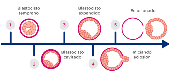 Clasificación de Blastocisto Clasificación de Blastocisto