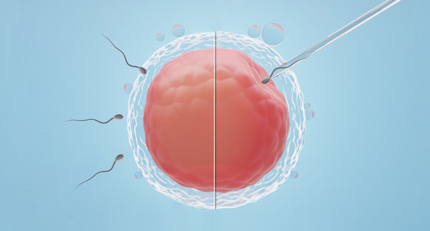 FIV classique ou ICSI : quelles sont les techniques et en quoi diffèrent-elles ? 