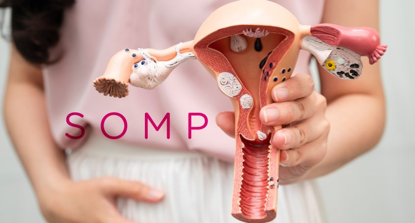 PCOS bekommt einen neuen Namen: Was ist das polyendokrine metabolische Ovarialsyndrom (PMOS) und was bedeutet es für Ihre Fruchtbarkeit?