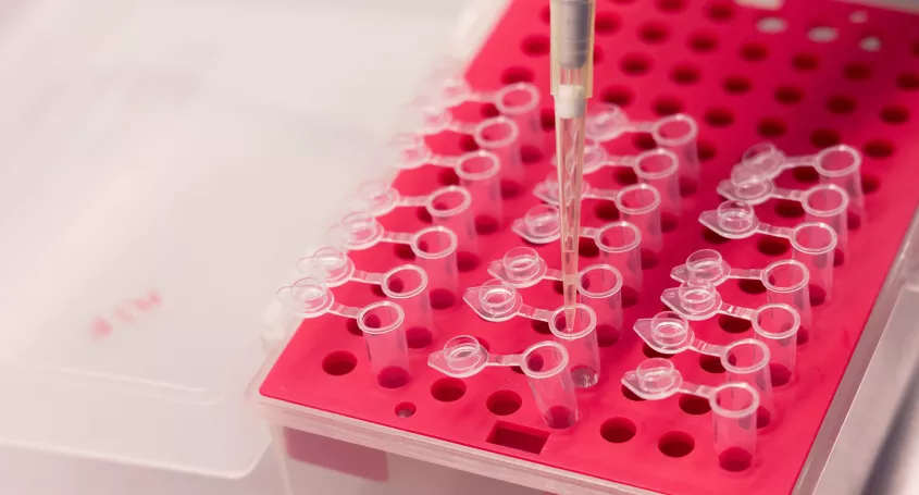 À quoi sert  une biopsie de l’endomètre?