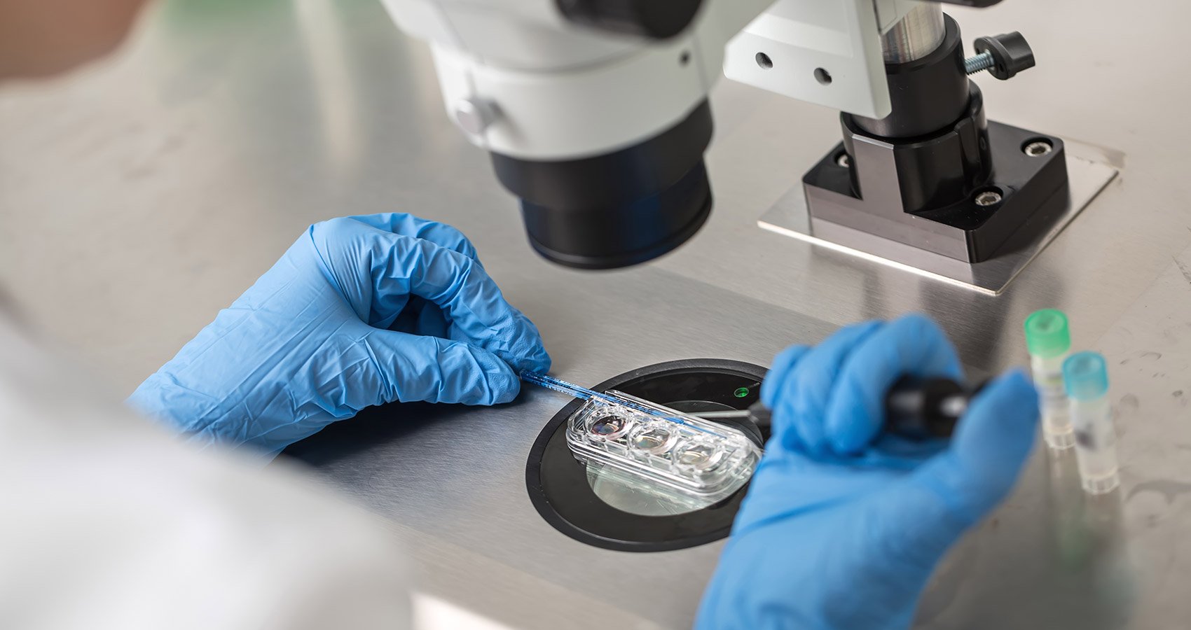 Unterschiede zwischen In-vitro-Fertilisation und knstlicher Befruchtung |  Barcelona IVF