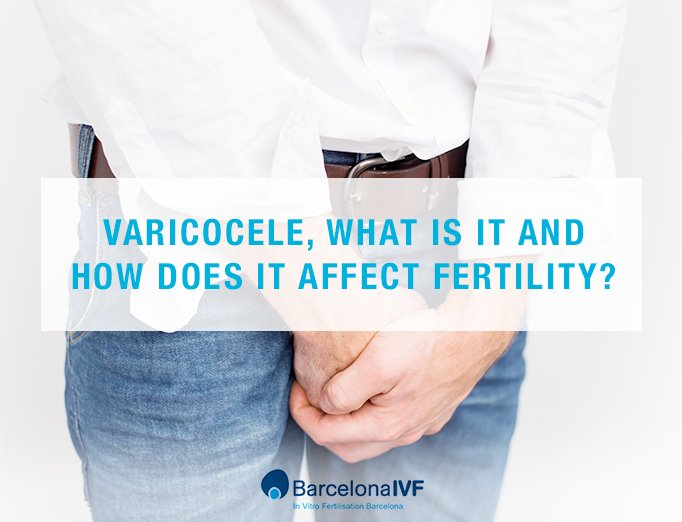 Varicocele: how does it affect fertility? 
