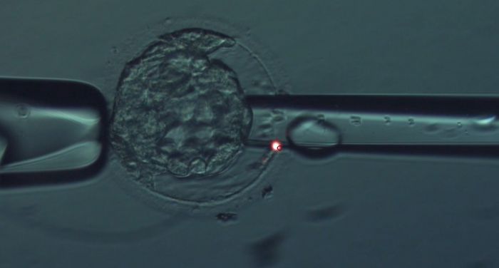 Qu'est-ce que le PGT-A et comment peut-il améliorer les chances de réussite en matière de fertilité ?