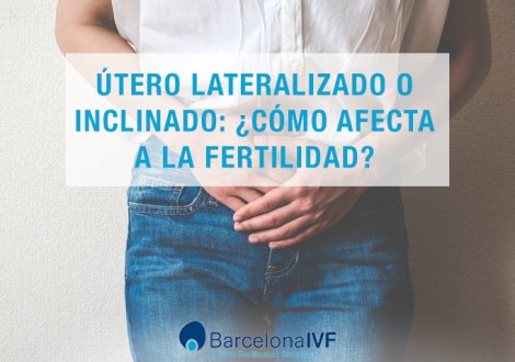 Útero lateralizado o inclinado: ¿cómo afecta a la fertilidad?