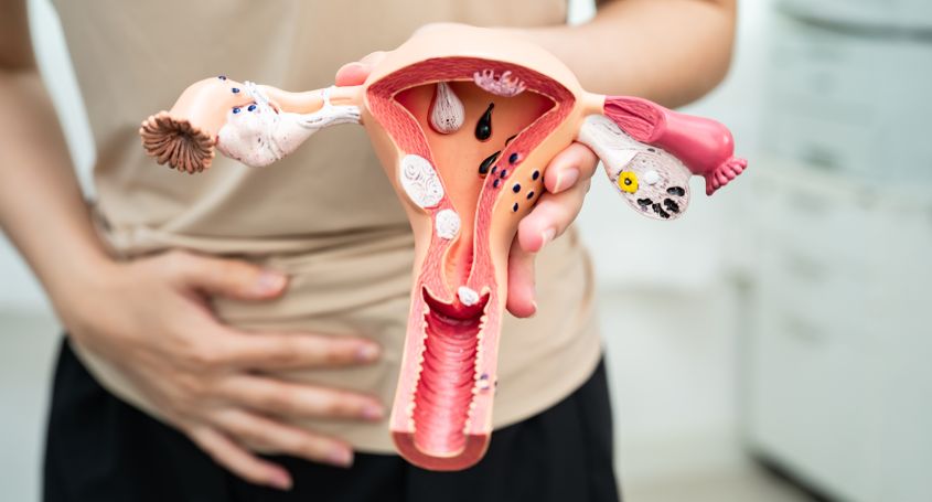 Vaginisme: què és, símptomes i tractaments efectius